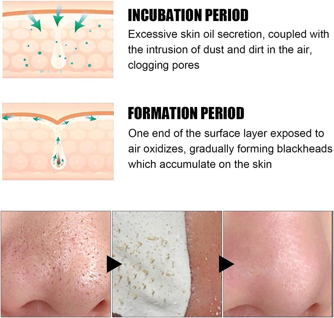 ClearPore™ | Nose Plant Pore Strips, Blackhead Remover Mask Pore Strips