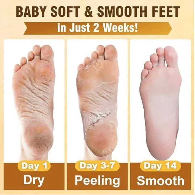 SilkSole™ | Soft Feet Peeling and Exfoliating Mask | With Korean skincare technology